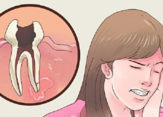 Remedies for toothache in Lichfield