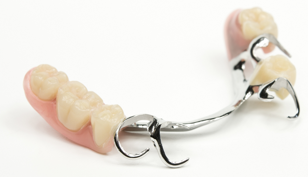 Dentures Full Partial Flexible Options Lichfield Birmingham Dentures Full Partial Flexible Options Lichfield Birmingham